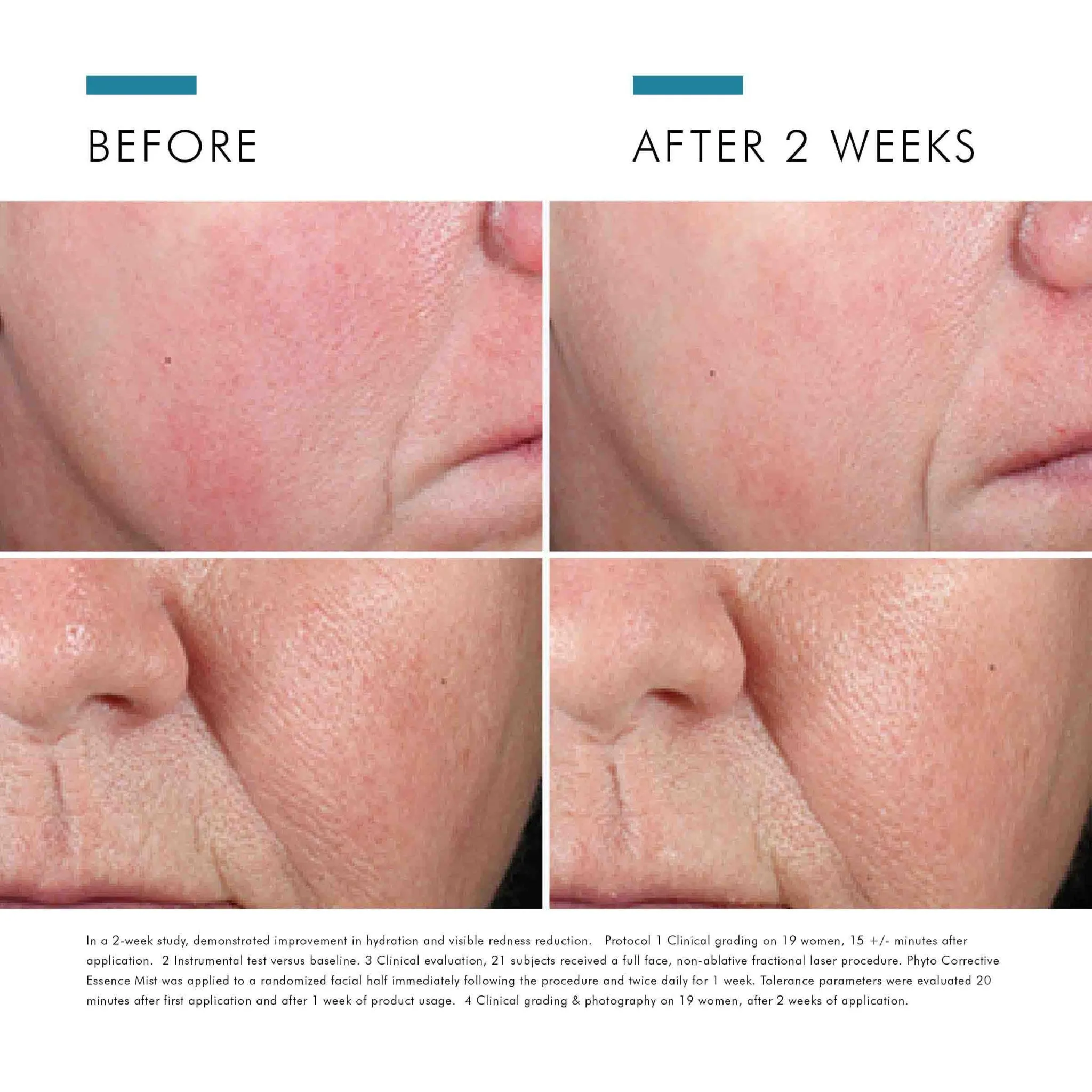 Phyto Corrective Essence Mist
